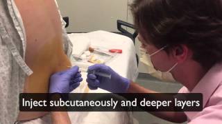 How to perform a lumbar puncture Lumbar puncture in the emergency department setting [upl. by Leuqim313]