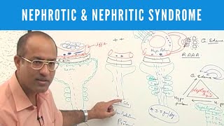 Nephrotic and Nephritic Syndrome  Causes Symptoms amp Treatment🩺 [upl. by Stewardson]