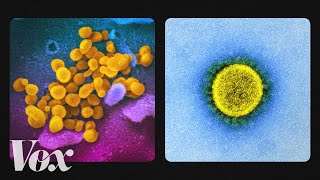 What the coronavirus looks like up close [upl. by Evelin]