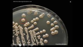 Candida albicans culture pathogenesis and laboratory diagnosis [upl. by Ettesel]