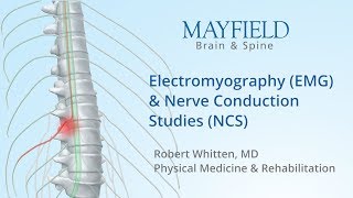 Electromyography EMG amp Nerve conduction studies NCS [upl. by Tim]