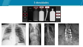 Principios físicos de radiología y tomografía [upl. by Tedie]