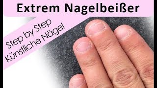 Nagelbeißer Extrem  Nagelmodellage Step by Step [upl. by Ynogoham475]