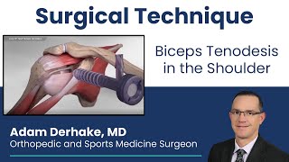 Biceps Tenodesis in the Shoulder Surgical Technique [upl. by Hime]