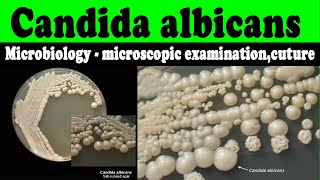 Candida albicans microbiology  microscopic examinationcuturelaboratory diagnosis [upl. by Patrizio]