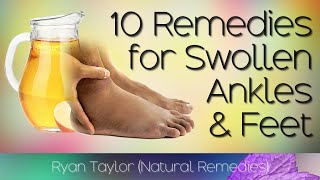 10 Home Remedies for Swollen Feet and Ankles [upl. by Yleoj18]