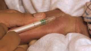 Tips to Ease Vaccination Pain in Babies [upl. by Clothilde]