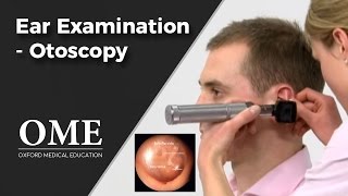 Otoscopy Ear Examination  ENT [upl. by Deppy]