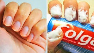 20 einfache Tricks für perfekte Fingernägel [upl. by Ubana518]