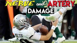 WORST College Football Injury Ever  Doctor Reviews McKenzie Milton Injury [upl. by Tamaru]