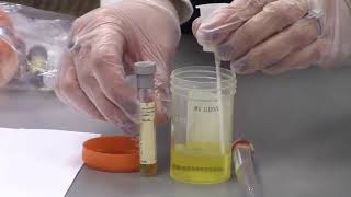 Urine Specimen Collection [upl. by Norword]