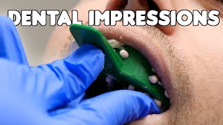 Dental Impressions amp Pouring Teeth Models [upl. by Ahsit]