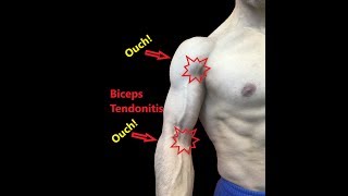 Biceps Tendonitis Treatment At Home Relieve Pain Fast [upl. by Morgan191]