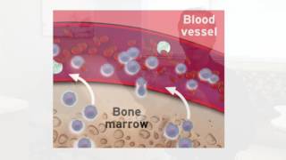 Stem Cell PreCollection and Mobilization [upl. by Bunch]