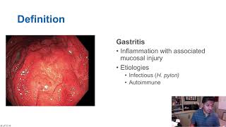 GORD GERD Gastro Oesophageal Reflux Disease  Overview pathophysiology treatment [upl. by Shayna]