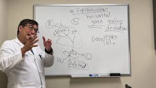 Horizontal Gaze Palsy  Strokes amp Seizures  Animation  Explained Conceptually [upl. by Nodab]