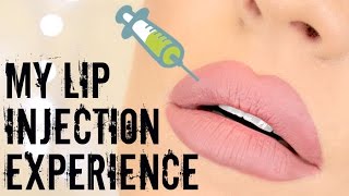 My Lip Injections Experience Laser Clinics Australia Lips to Love  Stephanie Lange [upl. by Alyat100]