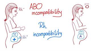 ABO incompatibility vs Rh incompatibility [upl. by Annav]