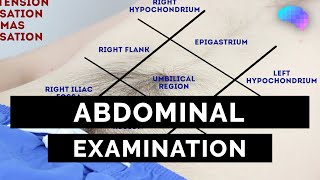 Abdominal Examination  OSCE Guide Latest  UKMLA  CPSA  PLAB 2 [upl. by Ykroc]