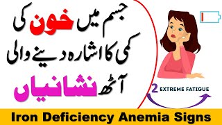 Iron Deficiency Anemia Signs and Symptoms [upl. by Dannie222]