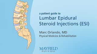 Lumbar Epidural Steroid Injections [upl. by Kram]