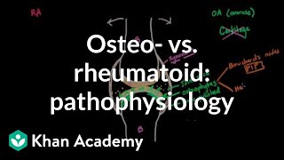 Rheumatoid Arthritis Pathophysiology and Drug Classification [upl. by Breger]