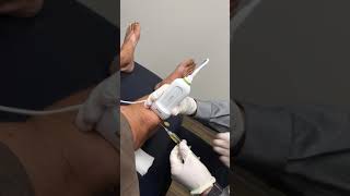 Prepatellar Bursa Aspiration  Elite Sports Medicine  Lethbridge [upl. by Bettye]