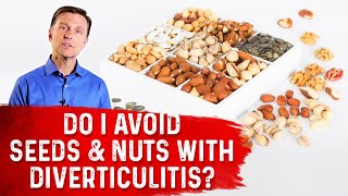 Should I Avoid Seeds amp Nuts with Diverticulitis – Dr Berg [upl. by Kaja]