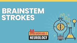 Brainstem Stroke Mnemonics Memorable Neurology Lecture 15 [upl. by Haldi]