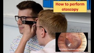 How to perform Otoscopy Ear Exam [upl. by Savick]