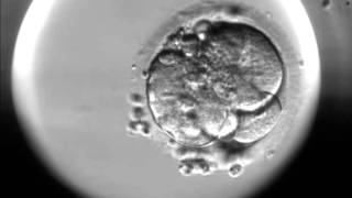 Timelapse of fertilisation of a human egg under the microscope [upl. by Alrick]