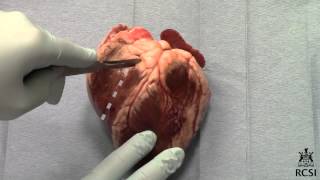 Sheeps Heart Dissection [upl. by Wrand127]