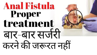 Fistula ka best treatment kya hai [upl. by Gokey]