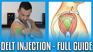 How To Do A Deltoid Injection  Full GuideDemo [upl. by Portwin309]