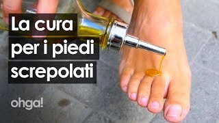 Piedi screpolati dopo lestate Ecco i rimedi naturali che non conoscevi [upl. by Ehsom488]