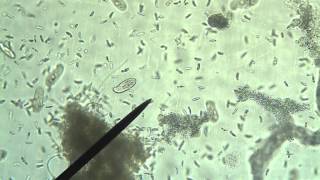 Protists Amoeba Euglena Paramecium [upl. by Clayborn]