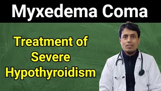 Myxedema Coma  Untreated Hypothyroidism  Serious Hypothyroidism  DrSanjayChestSpecialist [upl. by Dnallor]