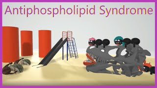 Antiphospholipid Syndrome Mnemonic for the USMLE [upl. by Cristie469]