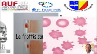 MORPHOLOGIE EN HEMATOLOGIE EPISODE 2 [upl. by Ellednek]