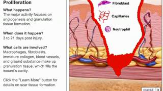 Stages of Wound Healing Process [upl. by Ydeh]