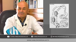 PARASITOSIS INTESTINAL  DR JORGE GAUNA [upl. by Marfe]