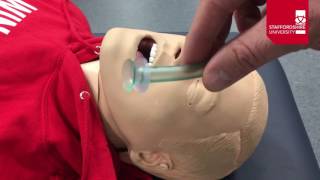 Nasopharyngeal Airway Insertion [upl. by Alehtse]