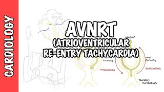 Normal Sinus Rhythm  EKG ECG Interpretation [upl. by Hannavahs]