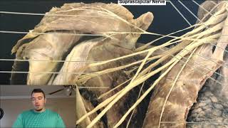 Brachial Plexus EXPLAINED Using a Cadaver [upl. by Allan]