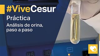 Análisis de orina 🔬 Descubre como realizarlo paso a paso 🙌 [upl. by Eluj419]