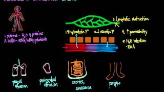 Disorders of Circulation Edema [upl. by Zakarias194]