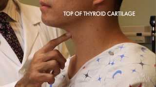 The Thyroid Exam Stanford Medicine 25 [upl. by Scarlett456]