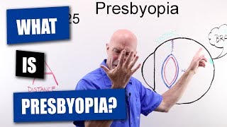 What Is Presbyopia [upl. by Yecart]