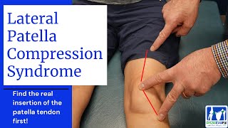 Patellofemoral Pain Syndrome Evaluation and Treatment [upl. by Meehsar]