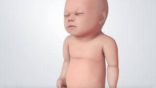 Infant Distress Warning Signs Grunting Baby Sound [upl. by Yetsirhc]